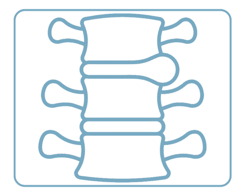 Disc Prolapse Management