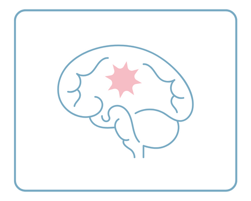 Epilepsy and Functional Neurosurgery