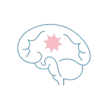Epilepsy and Functional Neurosurgery