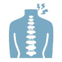 Lumbar Spondylosis