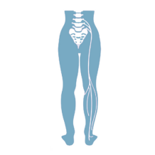 Sciatica