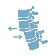 Spondylolisthesis Management
